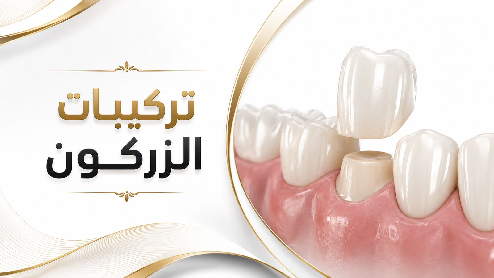 تركيبات الزركون