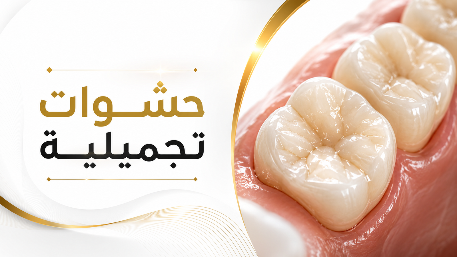 حشوات تجميلية